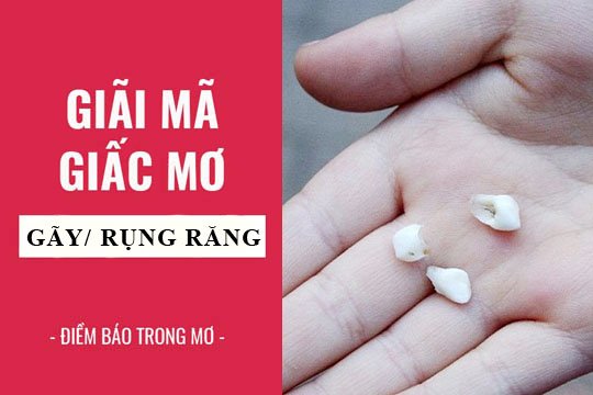 Mơ thấy Rụng Răng, Gãy Răng đánh con gì ? Báo điềm xấu hay tốt ?